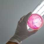 EHEC – orsak, symtom och behandling